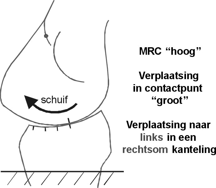 schuif